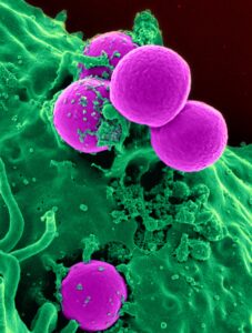 La Resistencia de las Membranas Acústicas a Bacterias y Hongos